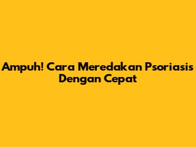 Ampuh! Cara Meredakan Psoriasis Dengan Cepat