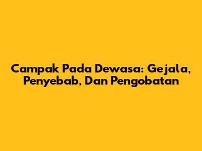 Campak Pada Dewasa: Gejala, Penyebab, Dan Pengobatan