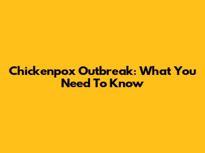 Chickenpox Outbreak: What You Need To Know