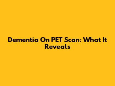 Dementia On PET Scan: What It Reveals