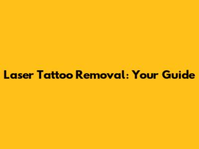 Laser Tattoo Removal: Your Guide