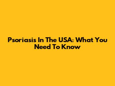 Psoriasis In The USA: What You Need To Know