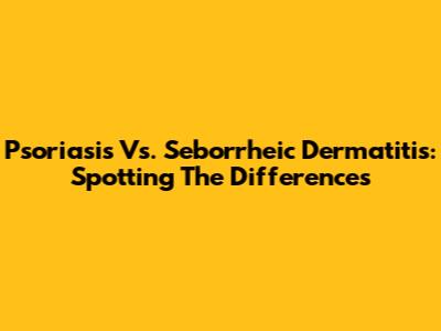 Psoriasis Vs. Seborrheic Dermatitis: Spotting The Differences