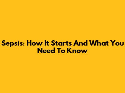 Sepsis: How It Starts And What You Need To Know