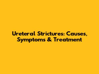 Ureteral Strictures: Causes, Symptoms & Treatment