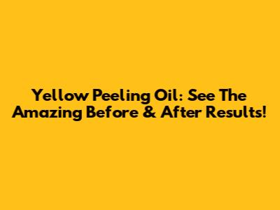 Yellow Peeling Oil: See The Amazing Before & After Results!
